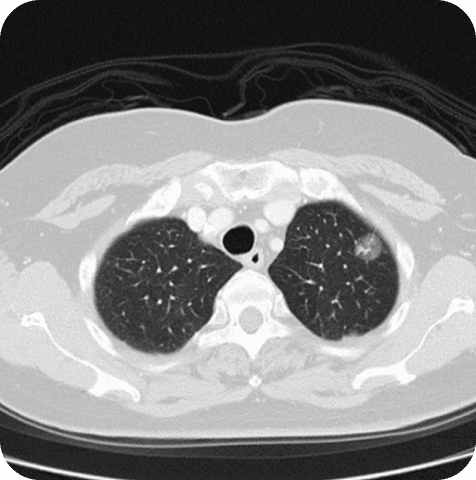 Chest CT original